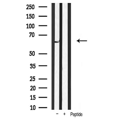Polyclonal Rabbit anti-Human PDPK1 / PDK1 Antibody (IHC, WB)