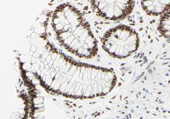 Polyclonal Rabbit anti-Human FOXO3 / FOXO3A Antibody (IHC, IF, WB)