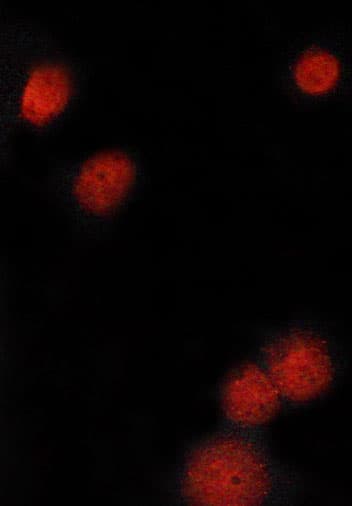 Polyclonal Rabbit anti-Human MITF Antibody (IHC, IF, WB)