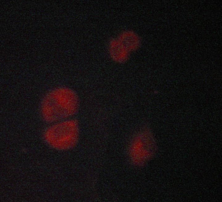 Polyclonal Rabbit anti-Human ADRB2 Antibody (IHC, IF, WB)