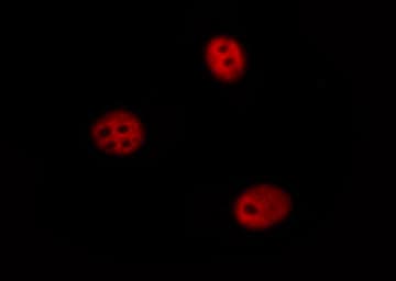 Polyclonal Rabbit anti-Human SP1 Antibody (IHC, IF, WB)