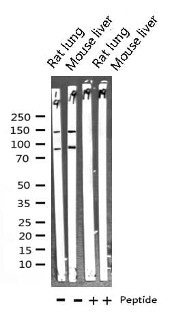 Polyclonal Rabbit anti-Human IGF1R / IGF1 Receptor Antibody (IF, WB)