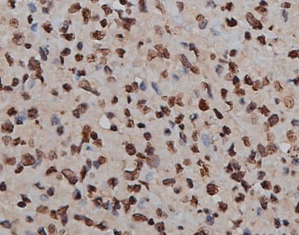 Polyclonal Rabbit anti-Human H2AFX / H2AX Antibody (IHC, WB)