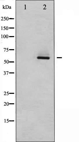 Polyclonal Rabbit anti-Human AKT2 Antibody (IHC, IF, WB)