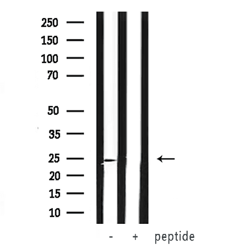 Polyclonal Rabbit anti-Human VHL / Von Hippel Lindau Antibody (IHC, WB)