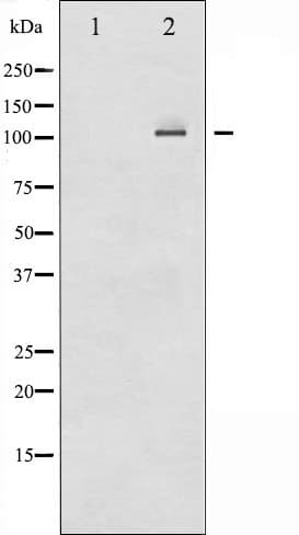 Polyclonal Rabbit anti-Human NFKB2 Antibody (IHC, IF, WB)
