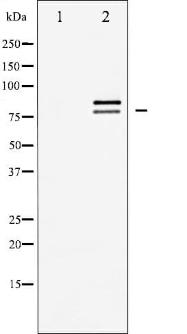 Polyclonal Rabbit anti-Human LIPE / HSL Antibody (IHC, IF, WB)