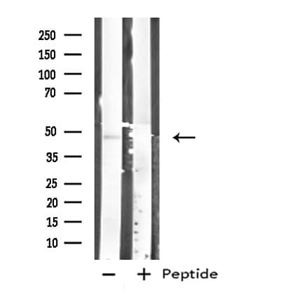 Polyclonal Rabbit anti-Human CPA1 / Carboxypeptidase A Antibody (IHC, IF, WB)
