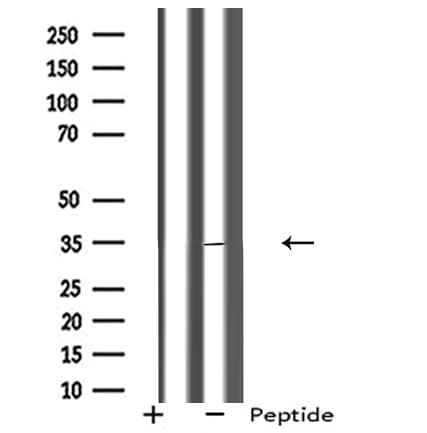 Polyclonal Rabbit anti-Human Rhodopsin / RHO Antibody (IHC, IF, WB)