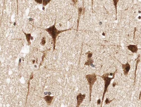 Polyclonal Rabbit anti-Human NFE2L2 / NRF2 Antibody (IHC, IF, WB)