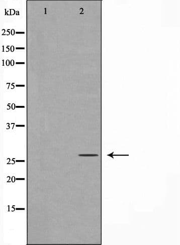Polyclonal Rabbit anti-Human VEGFA / VEGF Antibody (IHC, WB)