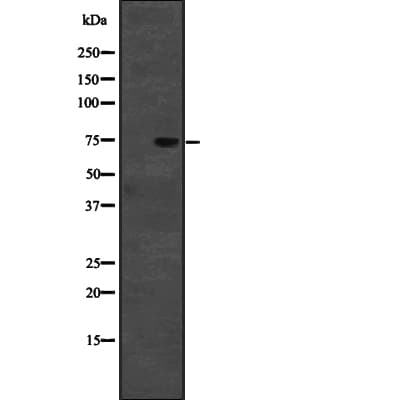 Polyclonal Rabbit anti-Human CD2AP Antibody (IF, WB)