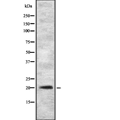 Polyclonal Rabbit anti-Human GKN2 / Gastrokine 2 Antibody (WB)