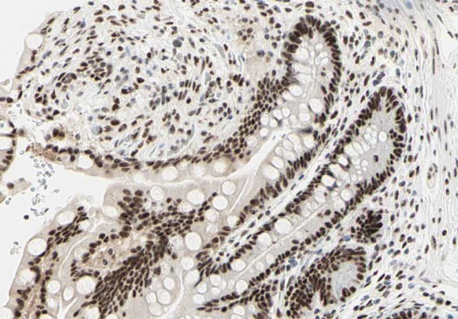 Polyclonal Rabbit anti-Human PRKDC / DNA-PKcs Antibody (IHC, IF, WB)