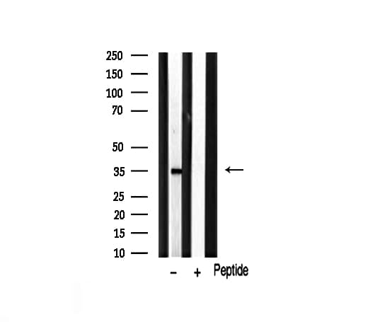 Polyclonal Rabbit anti-Human MAGEA1 / MAGE 1 Antibody (IHC, IF, WB)