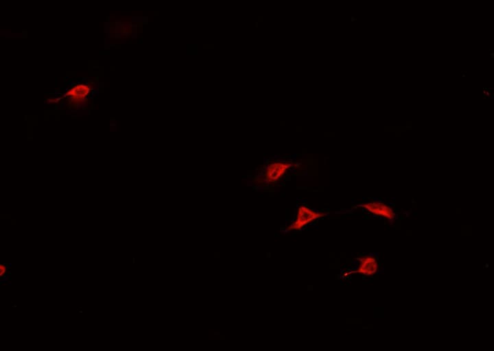 Polyclonal Rabbit anti-Human HAND1 Antibody (IF, WB)