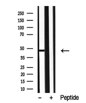 Polyclonal Rabbit anti-Human MAPK12 / ERK6 / SAPK3 Antibody (WB)