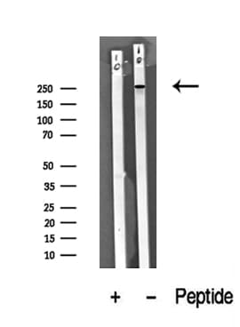 Polyclonal Rabbit anti-Human ROS1 / ROS Antibody (WB)