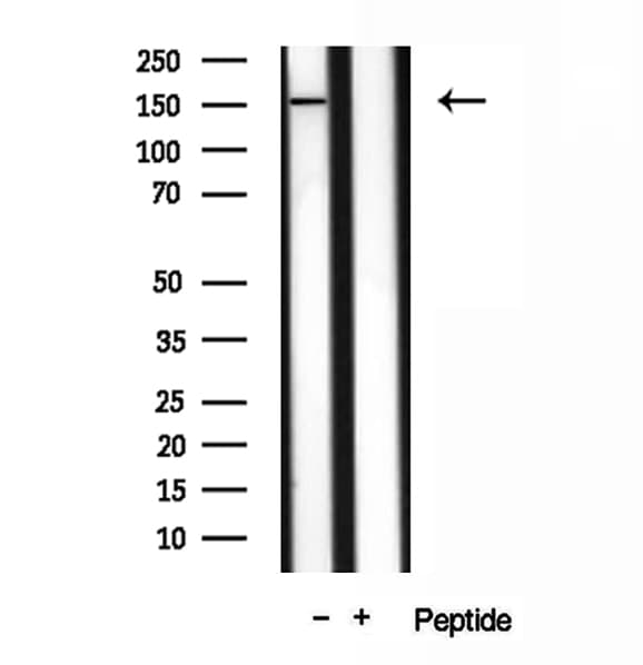 VPRBP Antibody