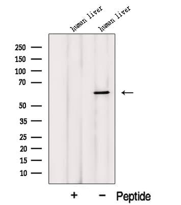 Polyclonal Rabbit anti-Human MCCC2 / MCCB Antibody (IF, WB)