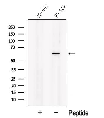 Polyclonal Rabbit anti-Human NOSTRIN Antibody (WB)