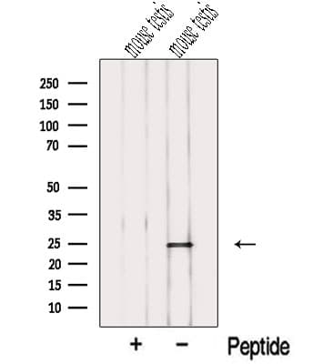 Polyclonal Rabbit anti-Human NME5 Antibody (WB)
