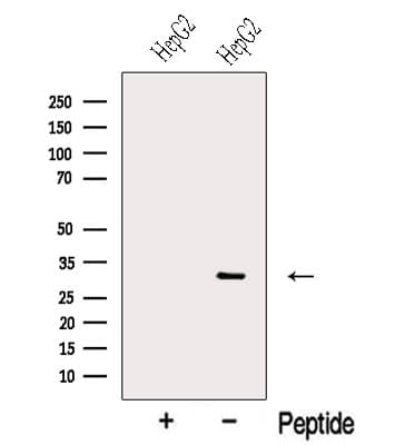 Polyclonal Rabbit anti-Human NNMT Antibody (WB)