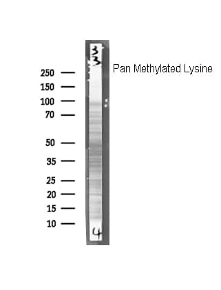 Polyclonal Rabbit anti-Human CD247 / CD3 Zeta Antibody (WB)