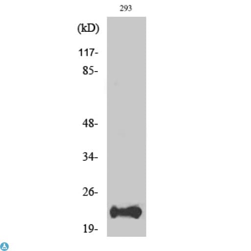 Polyclonal Rabbit anti-Human BAD Antibody (IHC, WB)