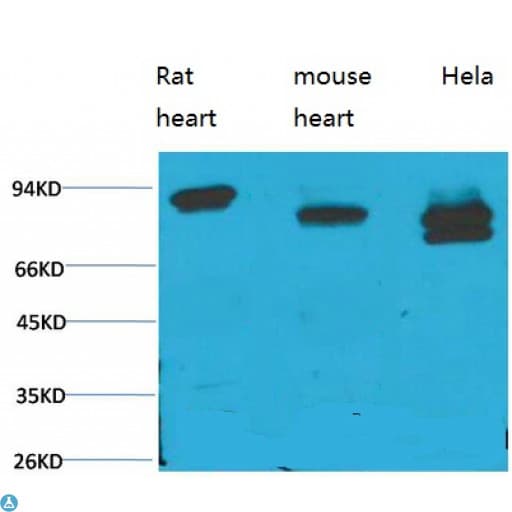 Monoclonal Mouse anti-Human STAT3 Antibody (IHC, WB)