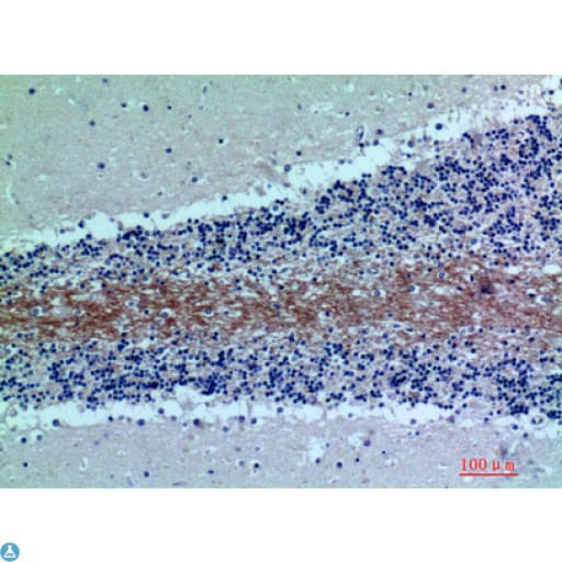 Polyclonal Rabbit anti-Human Complement C7 Antibody (IHC, WB)