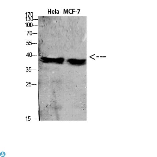 Polyclonal Rabbit anti-Human C5AR1 / CD88 / C5a Receptor Antibody (WB)