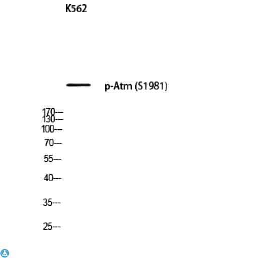 Polyclonal Rabbit anti-Human ATM Antibody (WB)