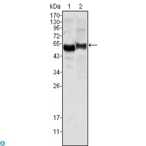 Monoclonal Mouse anti-Human SERPINA1 / Alpha 1 Antitrypsin Antibody (WB)
