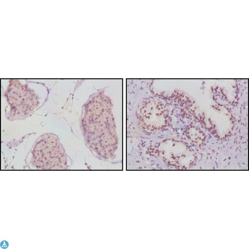 Monoclonal Mouse anti-Human AR / Androgen Receptor Antibody (IHC, WB)