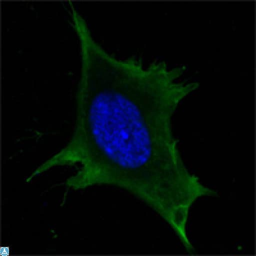 Monoclonal Mouse anti-Human CALR / Calreticulin Antibody (IHC, IF, WB)