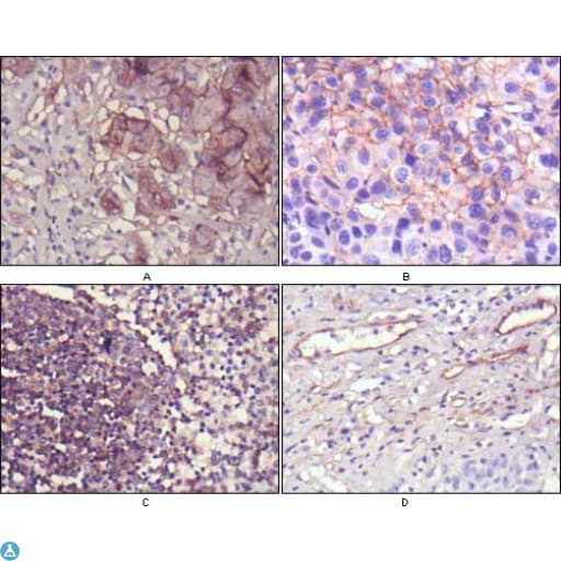 Monoclonal Mouse anti-Human NT5E / eNT / CD73 Antibody (IHC)