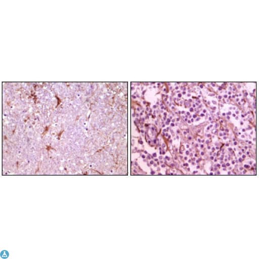 Monoclonal Mouse anti-Human CIB1 / KIP Antibody (IHC, WB)