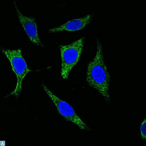 Monoclonal Mouse anti-Human KRT5 / CK5 / Cytokeratin 5 Antibody (IHC, IF)
