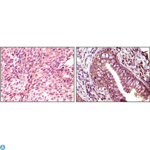 Monoclonal Mouse anti-Human EPHB6 / EPH Receptor B6 Antibody (IHC, WB)