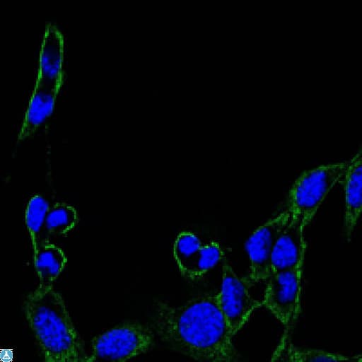 Monoclonal Mouse anti-Human FAK / Focal Adhesion Kinase Antibody (IHC, IF, WB)