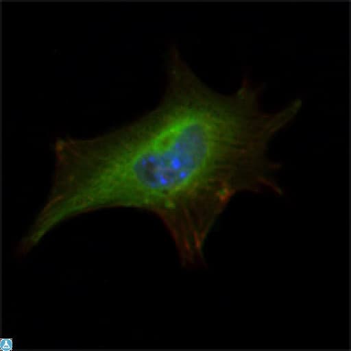 Monoclonal Mouse anti-Human FMR1 / FMRP Antibody (IHC, IF, WB)
