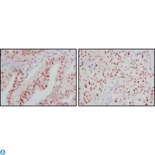 ATP2C1 Antibody