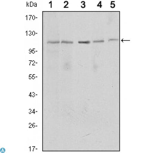 Monoclonal Mouse anti-Human SIRT1 / Sirtuin 1 Antibody (IHC, IF, WB)