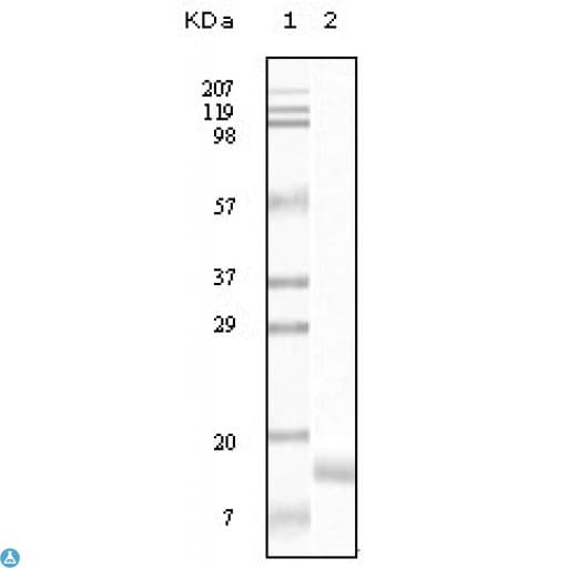 Monoclonal Mouse anti-Human SNCG / Gamma-Synuclein Antibody (IHC, WB)
