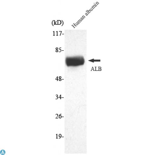 ALB / Serum Albumin Antibody