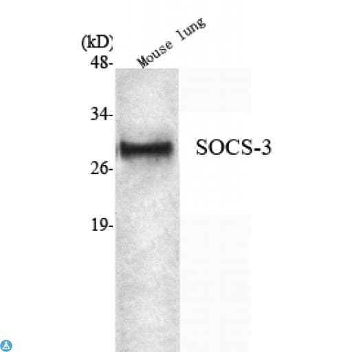 Monoclonal Mouse anti-Human SOCS3 Antibody (IHC, WB)