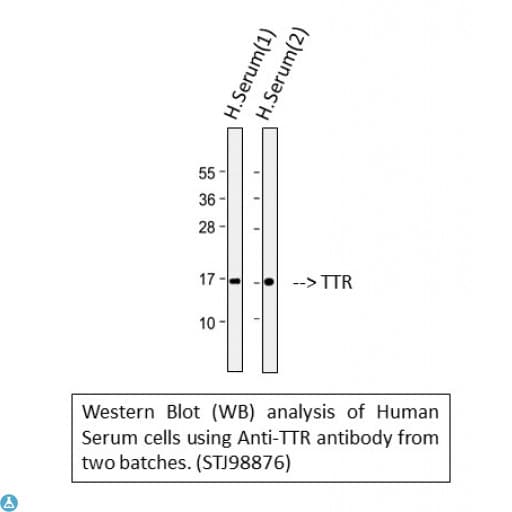 Monoclonal Mouse anti-Human TTR / Transthyretin Antibody (WB)