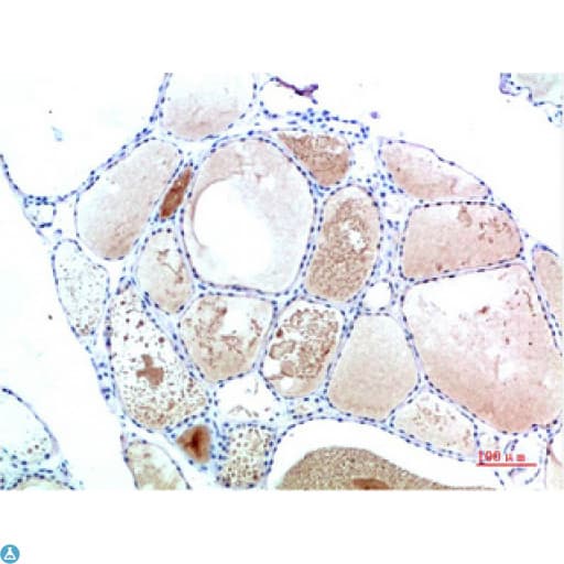 Monoclonal Mouse anti-Human TTR / Transthyretin Antibody (WB)