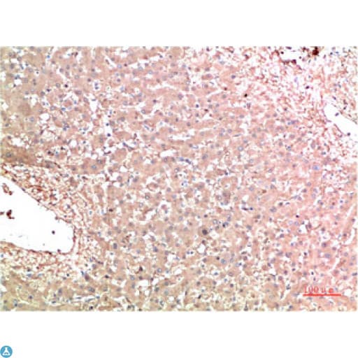 TTR / Transthyretin Antibody